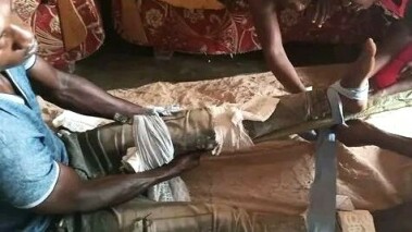 Muslim assailants broke Mukisa Siraji’s leg on May 28, 2024 near Iganga, Uganda. 